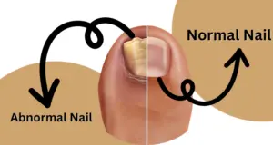 Visual Encyclopedia of Nail Abnormalities – Causes, Symptoms