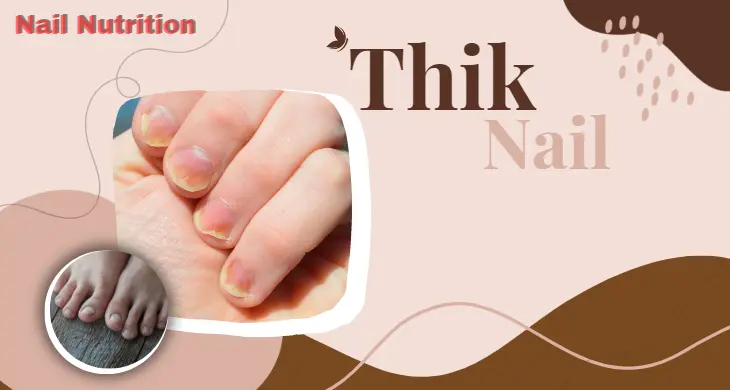 Nail Nutrition: Essential for Thick Nails