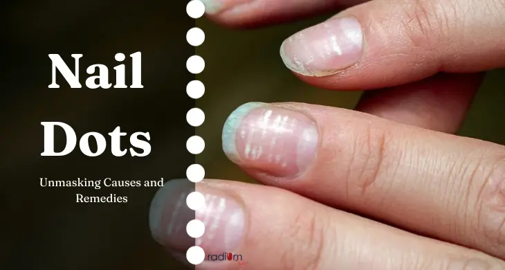 Nail-dots-unmasking-causes-and-remedies