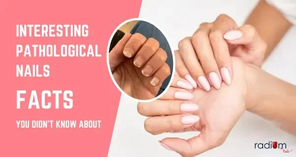 Interesting Pathological Nails Facts that you didn’t know about