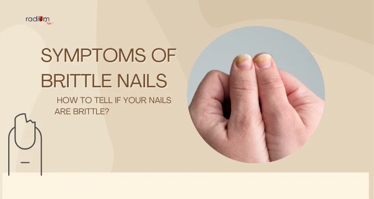 Symptoms of Brittle Nails